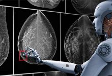 هوش مصنوعی در پزشکی ایران